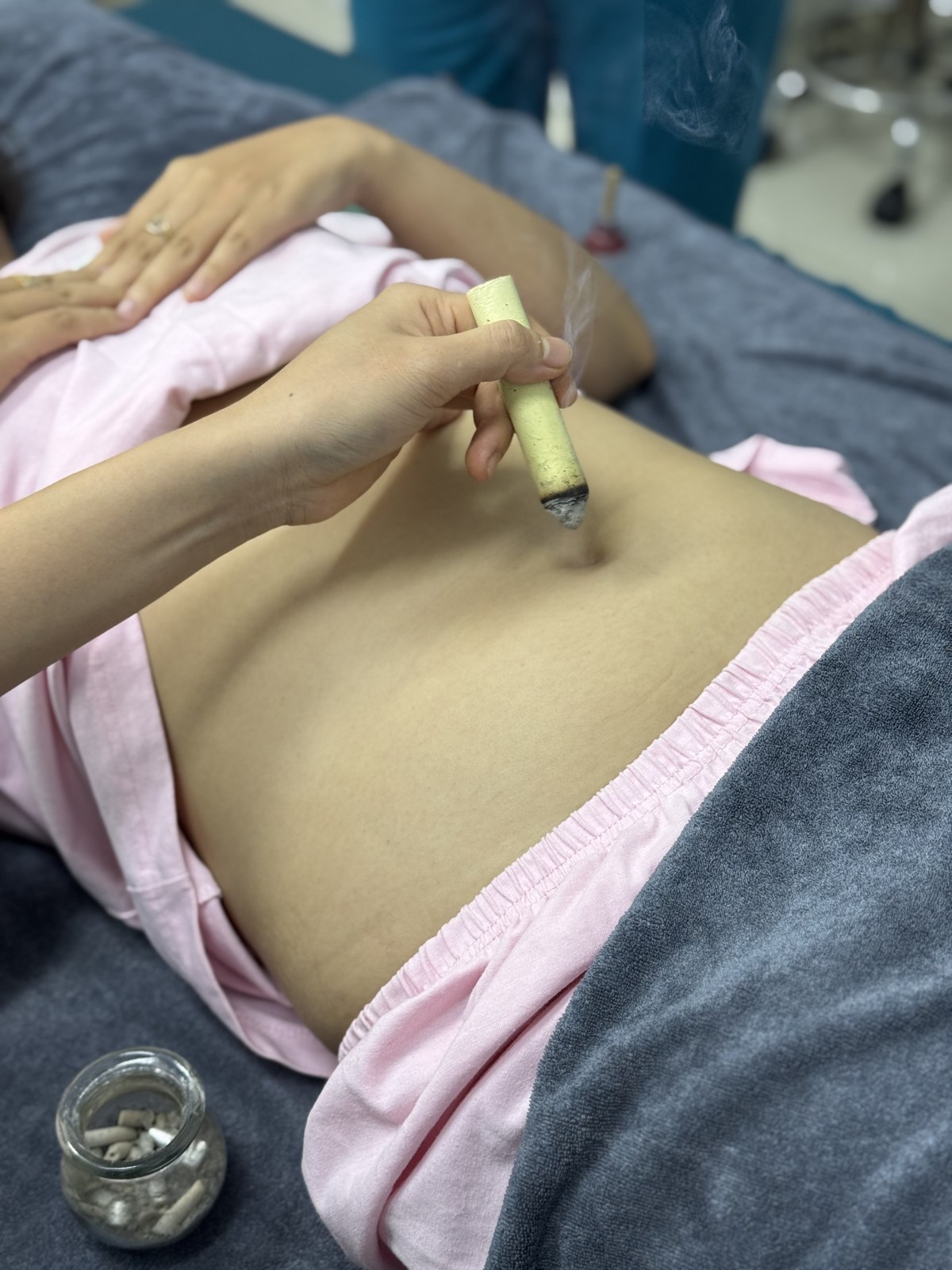 Hơ ngải thực tế tại CTM